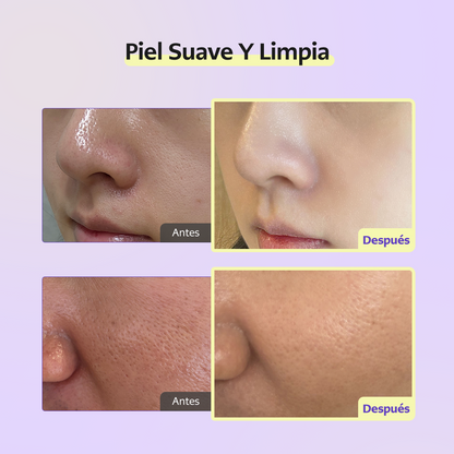 🚀 Cellology Purple Carrot Pore Ampoule 30mL